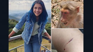 Sumbul Touqueer Khan Gets Bitten by Monkey During Ooty Trip, Shares Pics on Instagram